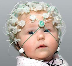Электроэнцефалограмма (ЭЭГ) - исследование функции головного мозга ребенка.